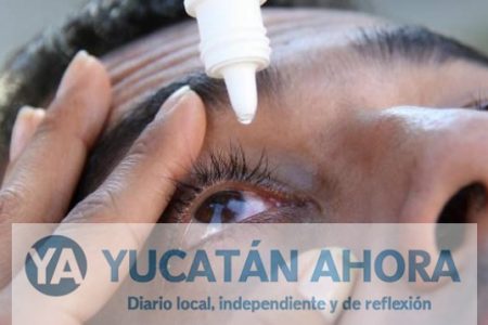 Secretario de Salud minimiza la conjuntivitis en Yucatán