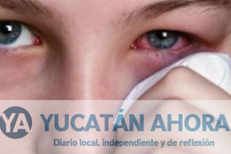 Yucatán rompe récord en conjuntivitis, un caso diagnosticado cada 20 segundos