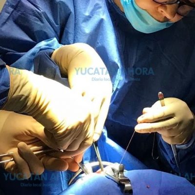Advierten de riesgos por cirujanos estéticos inexpertos en Yucatán