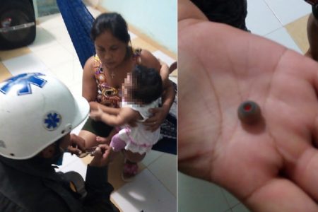 Bebé traga una goma de audífonos: casi muere asfixiada
