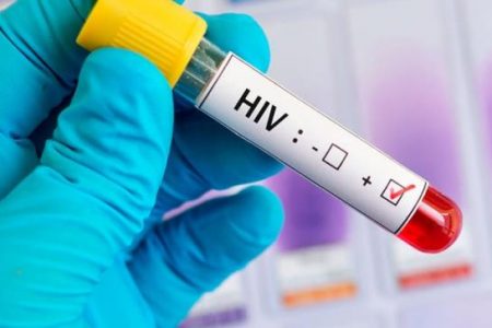 Yucatán suma más de 10 mil casos de VIH/SIDA