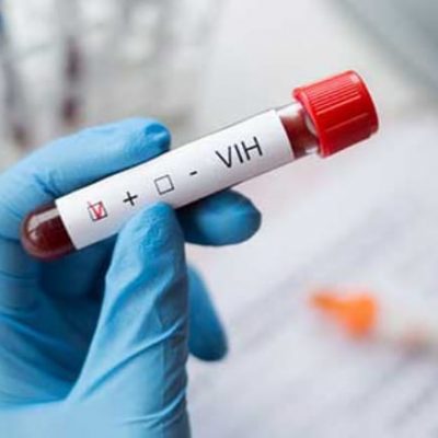 De 2020 a la fecha, se detectan cerca de 100 casos nuevos de VIH en Yucatán