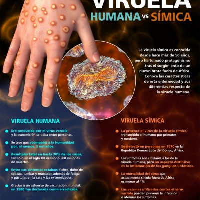 Viruela símica, impredecible pero no será pandemia