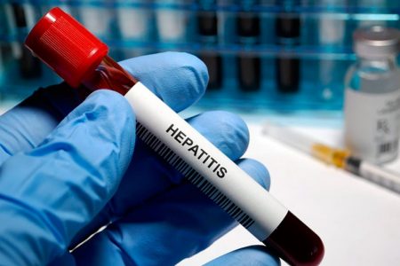 HEPATITIS AGUDA GRAVE CON UN CASO SOSPECHOSO MÁS EN YUCATÁN